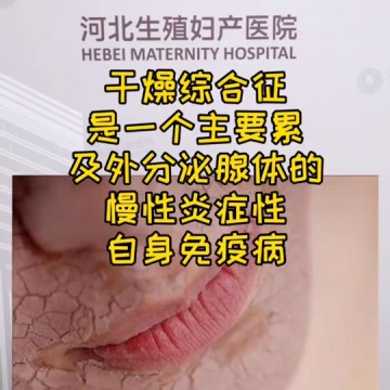 干燥综合征